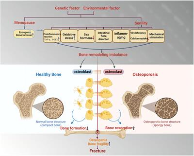 The potential therapeutic role of curcumin in osteoporosis treatment: based on multiple signaling pathways